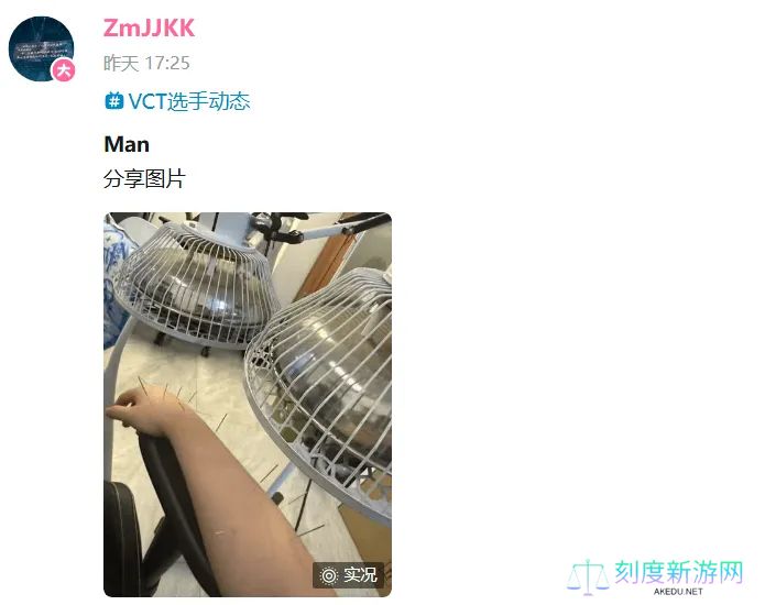快点恢复哇！ZmjjKK选手分享针灸理疗照片